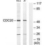 Western blot - CDC20 Antibody from Signalway Antibody (34189) - Antibodies.com