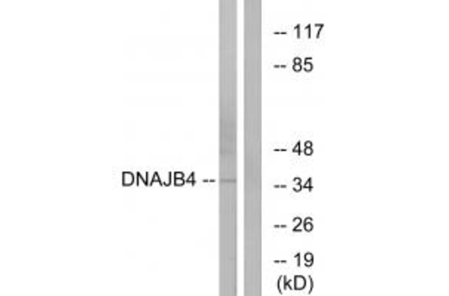 Western blot - DNAJB4 Antibody from Signalway Antibody (34246) - Antibodies.com