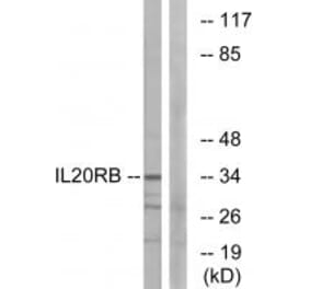 Western blot - IL20RB Antibody from Signalway Antibody (34254) - Antibodies.com