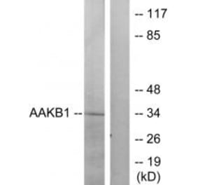 Western blot - PRKAB1 Antibody from Signalway Antibody (34258) - Antibodies.com
