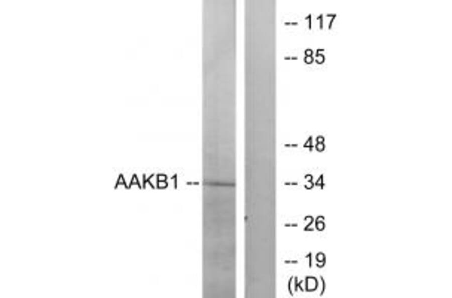 Western blot - PRKAB1 Antibody from Signalway Antibody (34258) - Antibodies.com