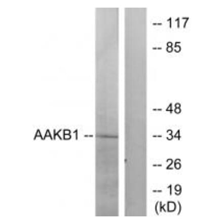 Western blot - PRKAB1 Antibody from Signalway Antibody (34258) - Antibodies.com