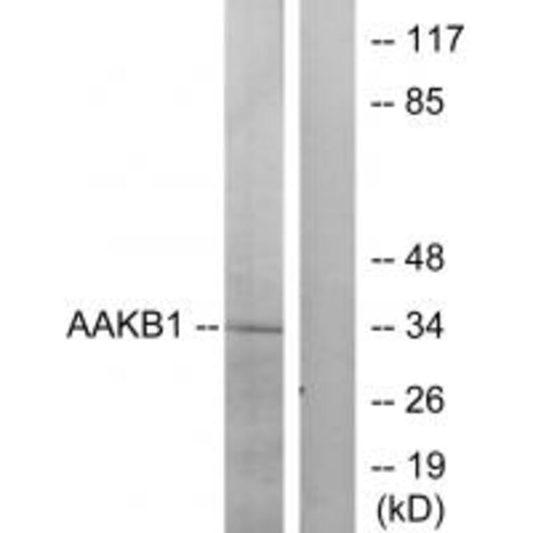 Western blot - PRKAB1 Antibody from Signalway Antibody (34258) - Antibodies.com