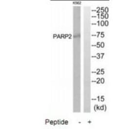 Western blot - PARP2 Antibody from Signalway Antibody (34292) - Antibodies.com