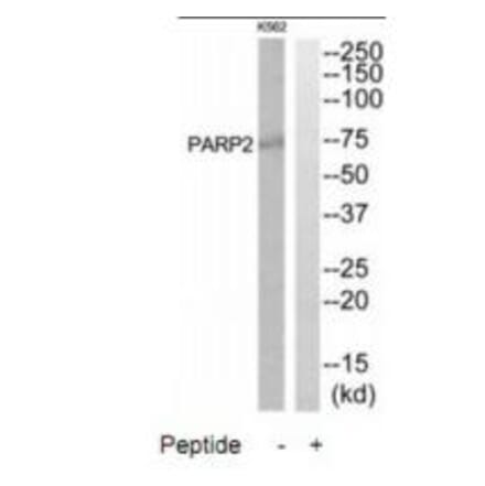 Western blot - PARP2 Antibody from Signalway Antibody (34292) - Antibodies.com