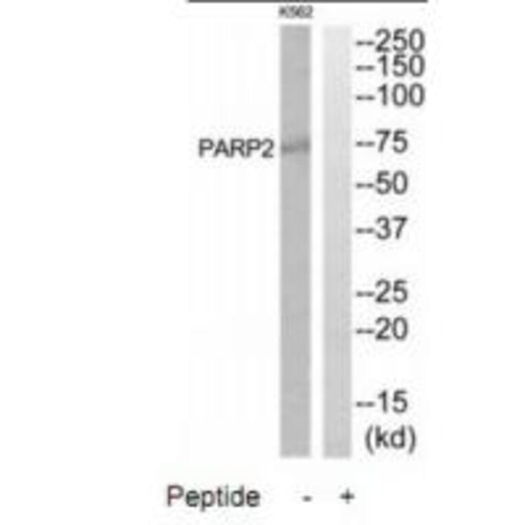 Western blot - PARP2 Antibody from Signalway Antibody (34292) - Antibodies.com