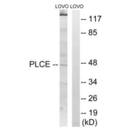 Western blot - AGPAT5 Antibody from Signalway Antibody (34304) - Antibodies.com