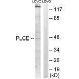 Western blot - AGPAT5 Antibody from Signalway Antibody (34304) - Antibodies.com