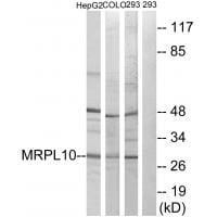 Western blot analysis of extracts from HepG2 cells, COLO cells and 293 cells, using MRPL10 antibody #34314.