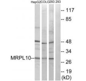 Western blot - MRPL10 Antibody from Signalway Antibody (34314) - Antibodies.com