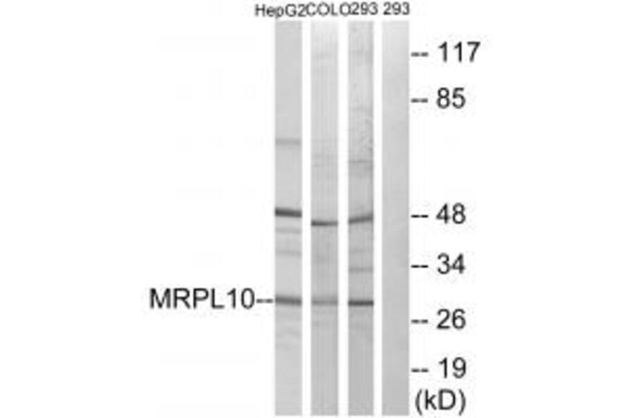 Western blot - MRPL10 Antibody from Signalway Antibody (34314) - Antibodies.com