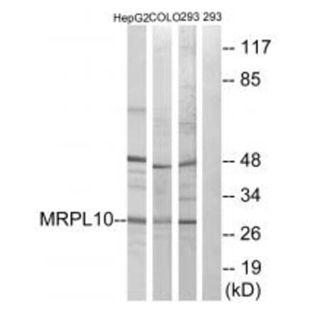 Western blot - MRPL10 Antibody from Signalway Antibody (34314) - Antibodies.com