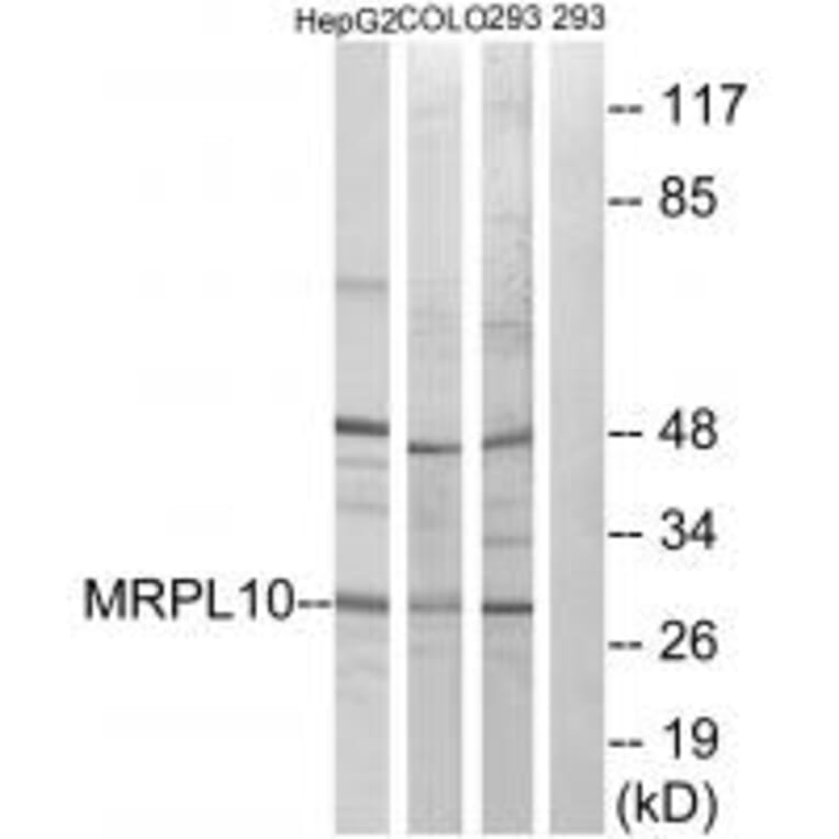 Western blot - MRPL10 Antibody from Signalway Antibody (34314) - Antibodies.com