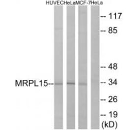 Western blot - MRPL15 Antibody from Signalway Antibody (34319) - Antibodies.com