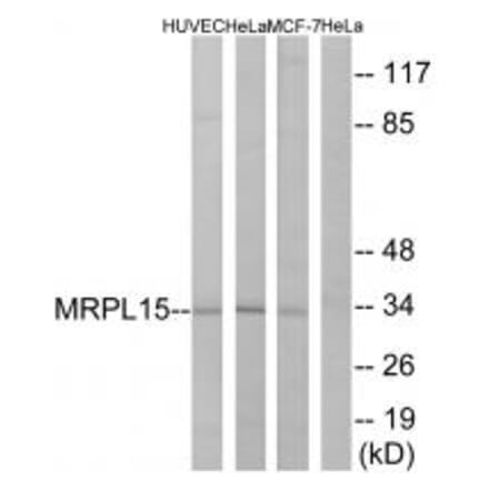 Western blot - MRPL15 Antibody from Signalway Antibody (34319) - Antibodies.com