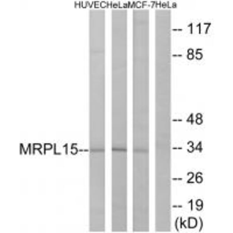Western blot - MRPL15 Antibody from Signalway Antibody (34319) - Antibodies.com