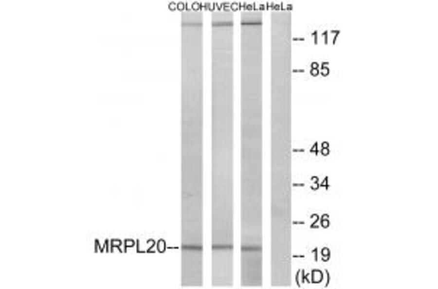 Western blot - MRPL20 Antibody from Signalway Antibody (34322) - Antibodies.com