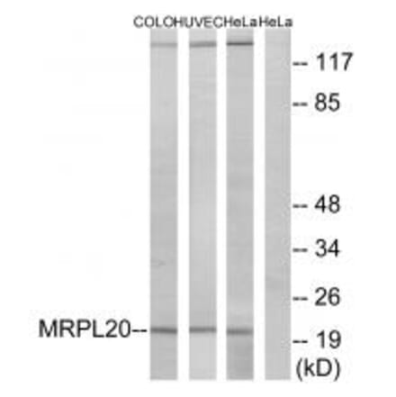 Western blot - MRPL20 Antibody from Signalway Antibody (34322) - Antibodies.com