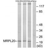 Western blot - MRPL20 Antibody from Signalway Antibody (34322) - Antibodies.com