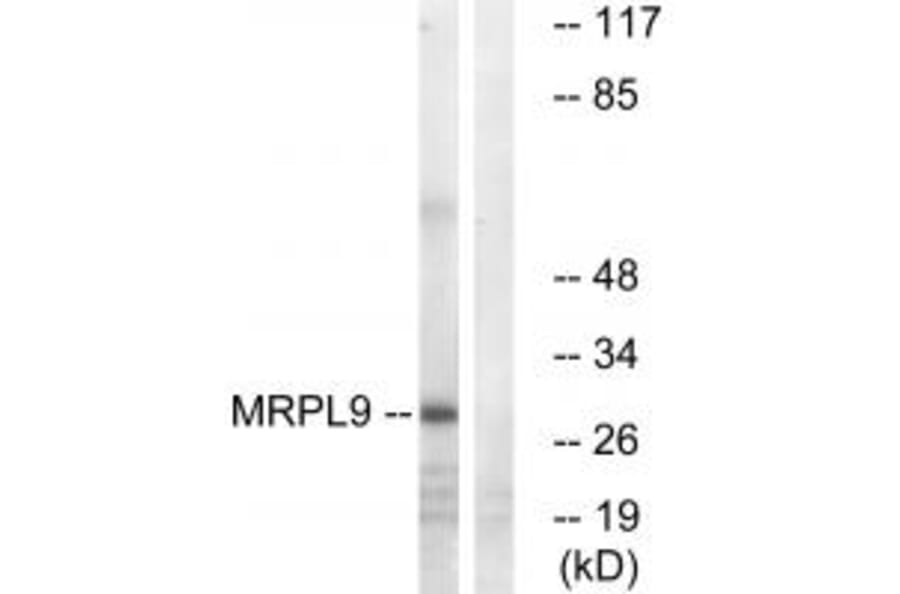 Western blot - MRPL9 Antibody from Signalway Antibody (34326) - Antibodies.com