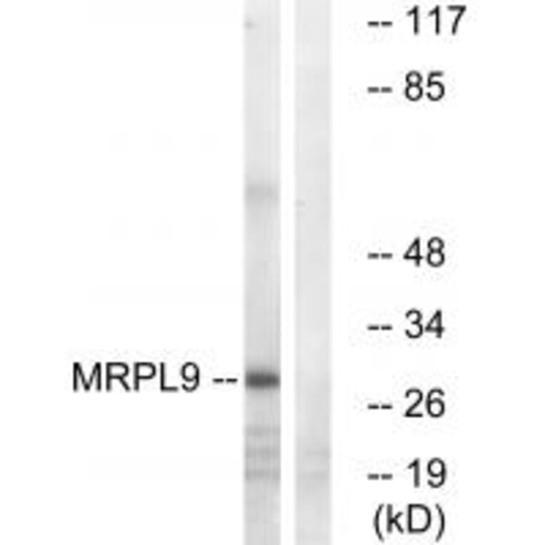 Western blot - MRPL9 Antibody from Signalway Antibody (34326) - Antibodies.com