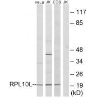 Western blot analysis of extracts from HeLa cells, Jurkat cells and COS7 cells, using RPL10L antibody #34345.