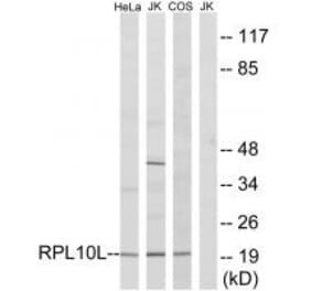 Western blot - RPL10L Antibody from Signalway Antibody (34345) - Antibodies.com