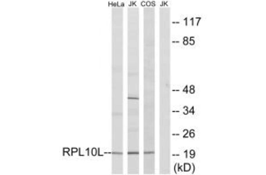 Western blot - RPL10L Antibody from Signalway Antibody (34345) - Antibodies.com