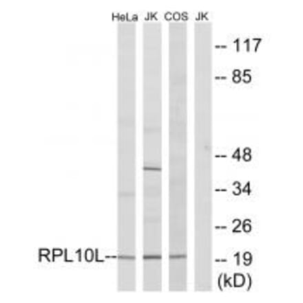 Western blot - RPL10L Antibody from Signalway Antibody (34345) - Antibodies.com