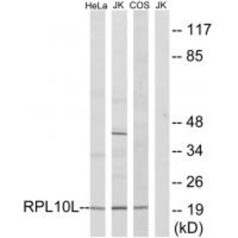 Western blot - RPL10L Antibody from Signalway Antibody (34345) - Antibodies.com