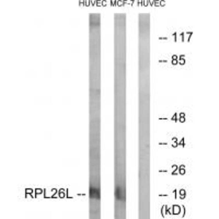 Western blot - RPL26L Antibody from Signalway Antibody (34350) - Antibodies.com
