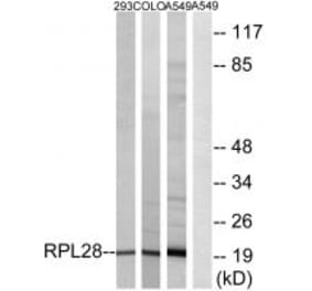RPL28 Antibody from Signalway Antibody (34352) - Antibodies.com