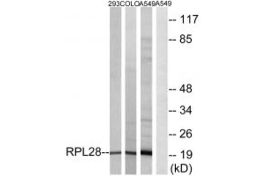 RPL28 Antibody from Signalway Antibody (34352) - Antibodies.com