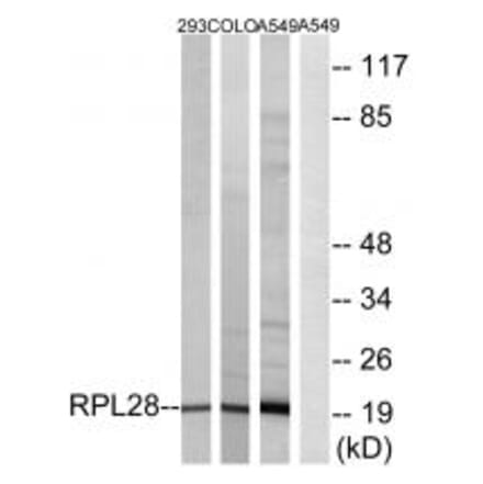RPL28 Antibody from Signalway Antibody (34352) - Antibodies.com