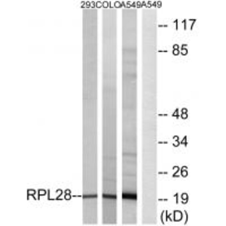 RPL28 Antibody from Signalway Antibody (34352) - Antibodies.com