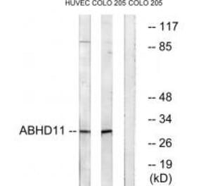 Western blot - ABHD11 Antibody from Signalway Antibody (34366) - Antibodies.com