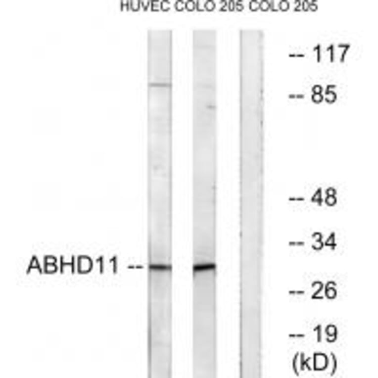 Western blot - ABHD11 Antibody from Signalway Antibody (34366) - Antibodies.com