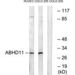 Western blot - ABHD11 Antibody from Signalway Antibody (34366) - Antibodies.com