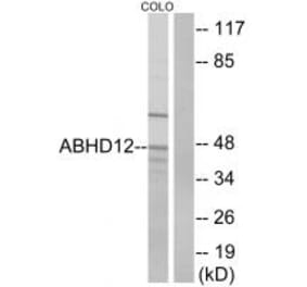 Western blot - ABHD12 Antibody from Signalway Antibody (34367) - Antibodies.com