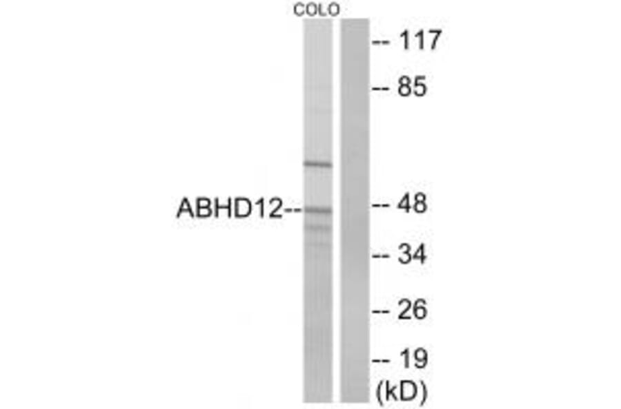 Western blot - ABHD12 Antibody from Signalway Antibody (34367) - Antibodies.com