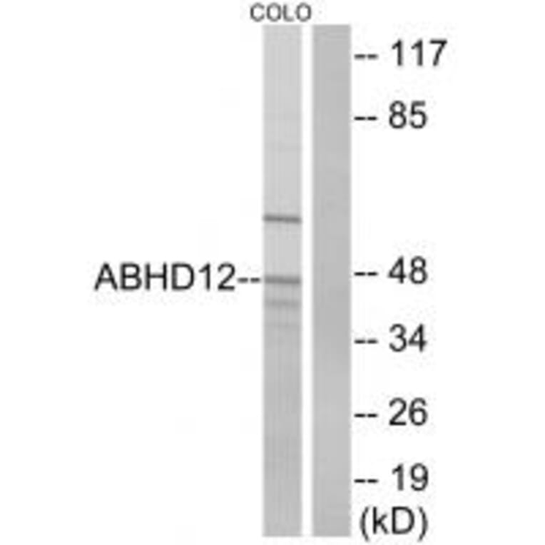 Western blot - ABHD12 Antibody from Signalway Antibody (34367) - Antibodies.com