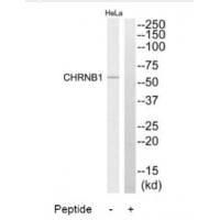 Western blot analysis of extracts from HeLa cells, using CHRNB1 antibody #34374.