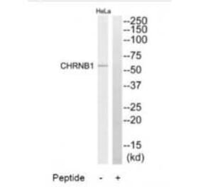 Western blot - CHRNB1 Antibody from Signalway Antibody (34374) - Antibodies.com