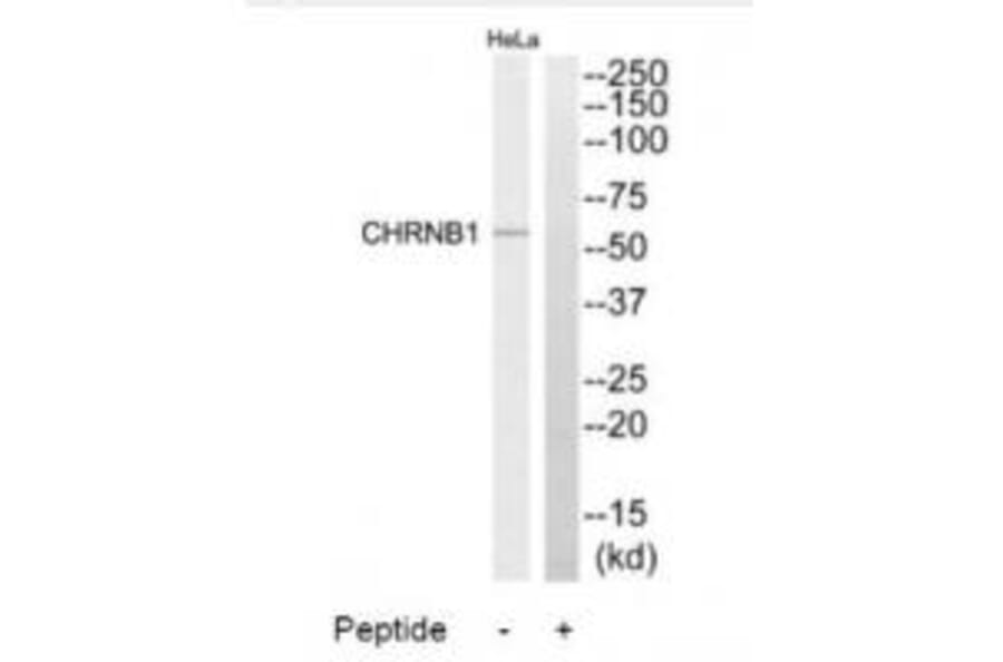 Western blot - CHRNB1 Antibody from Signalway Antibody (34374) - Antibodies.com