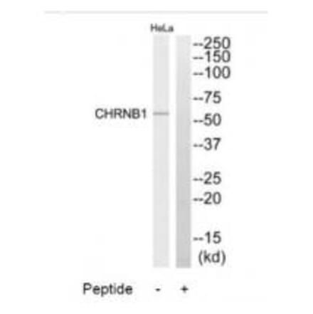 Western blot - CHRNB1 Antibody from Signalway Antibody (34374) - Antibodies.com