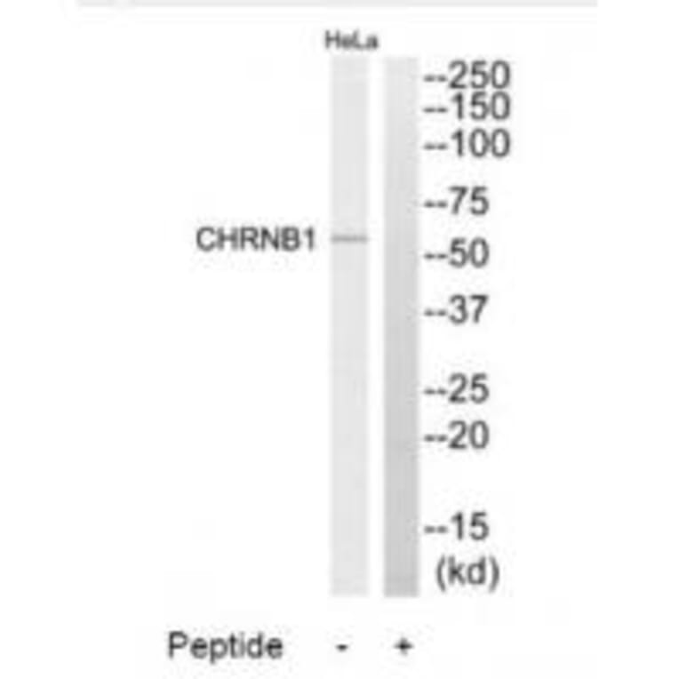 Western blot - CHRNB1 Antibody from Signalway Antibody (34374) - Antibodies.com