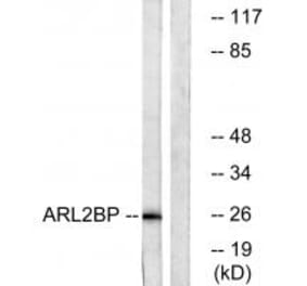 Western blot - ARL2BP Antibody from Signalway Antibody (34394) - Antibodies.com