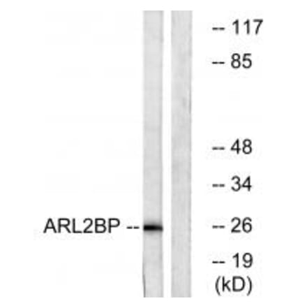 Western blot - ARL2BP Antibody from Signalway Antibody (34394) - Antibodies.com