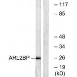 Western blot - ARL2BP Antibody from Signalway Antibody (34394) - Antibodies.com