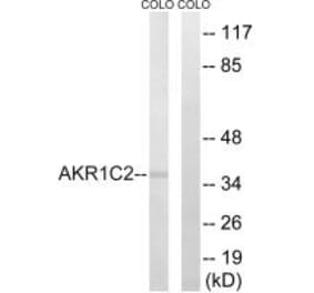 Western blot - AKR1C2 Antibody from Signalway Antibody (34400) - Antibodies.com